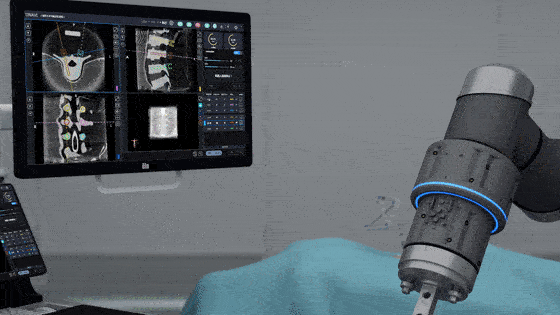 1717053920571326.gif 1717053920571326.gif